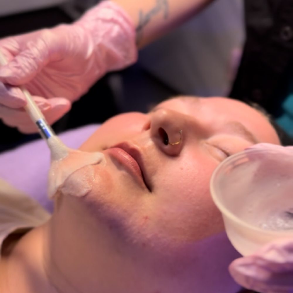 A treatment mask being applied